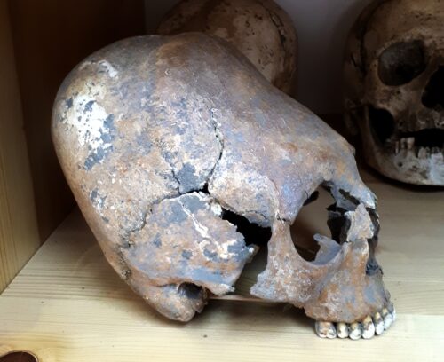 Deformed skull dated to the 4th century CE, attributed to an individual from the steppes. Originally labelled by archaeologists as possibly Gepid or Goth. Credit: Carles Lalueza-Fox.